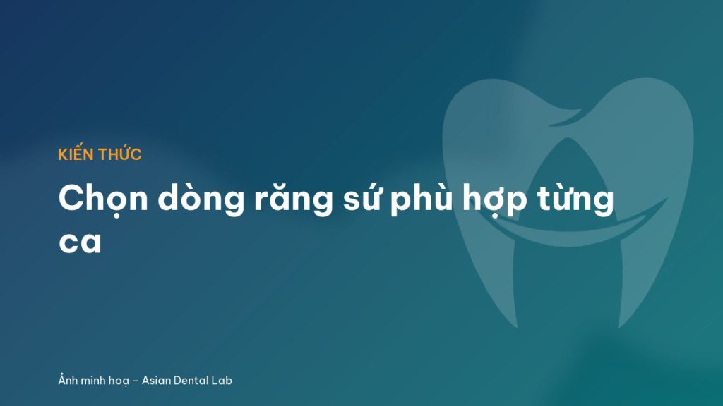 Chọn dòng răng sứ phù hợp từng ca