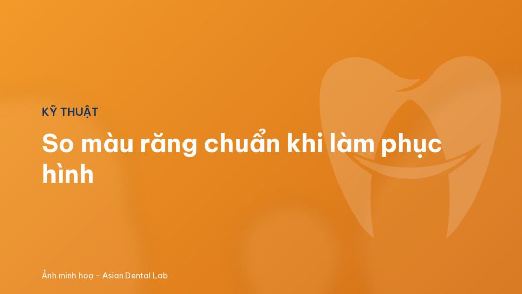 So màu răng chuẩn khi làm phục hình