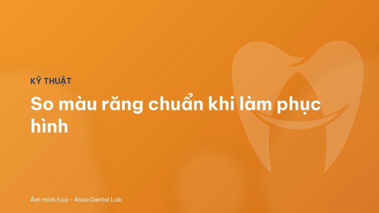 So màu răng chuẩn khi làm phục hình