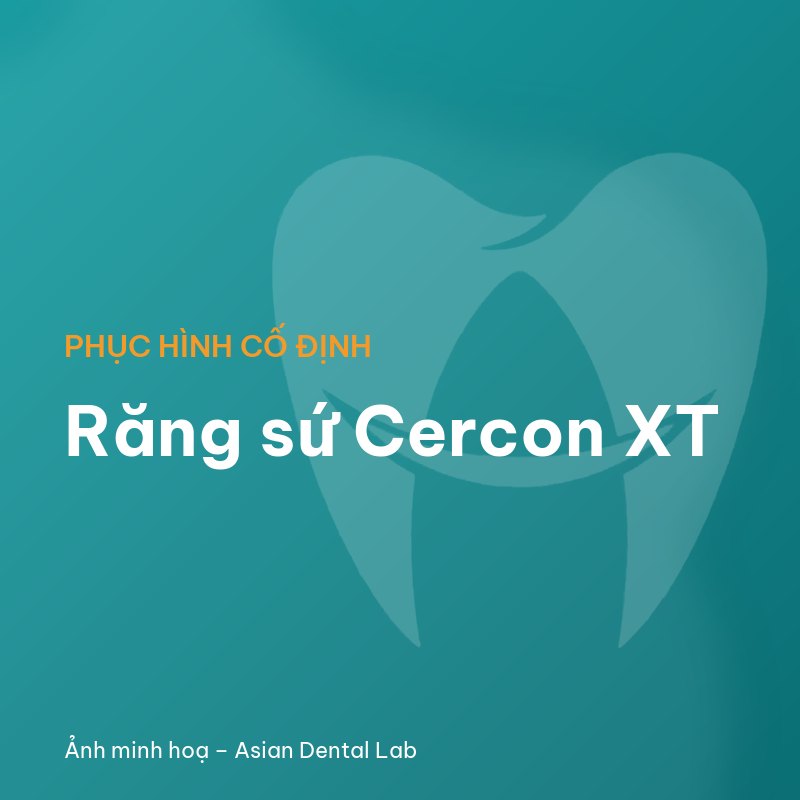 Răng sứ Cercon XT