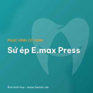 Sứ ép E.max Press