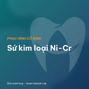 Sứ kim loại Ni-Cr