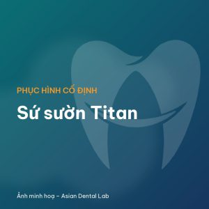 Sứ sườn Titan