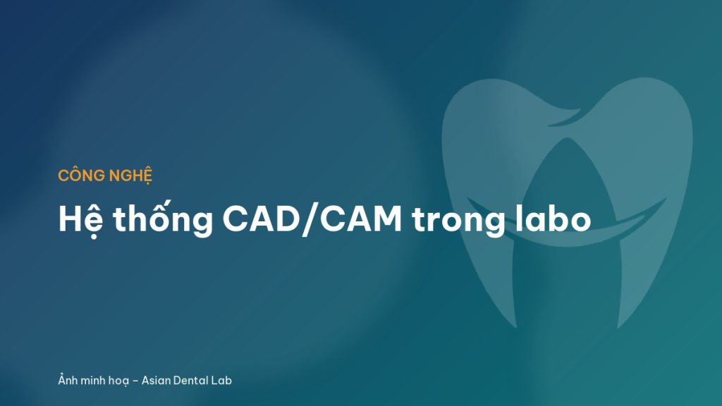 Hệ thống CAD/CAM trong labo