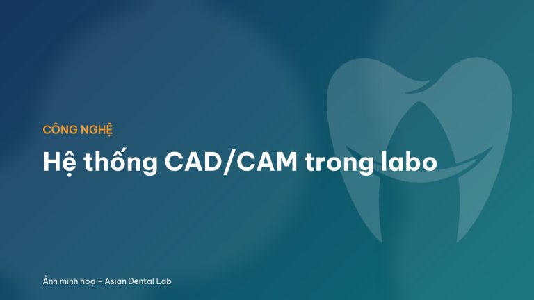 Hệ thống CAD/CAM trong labo
